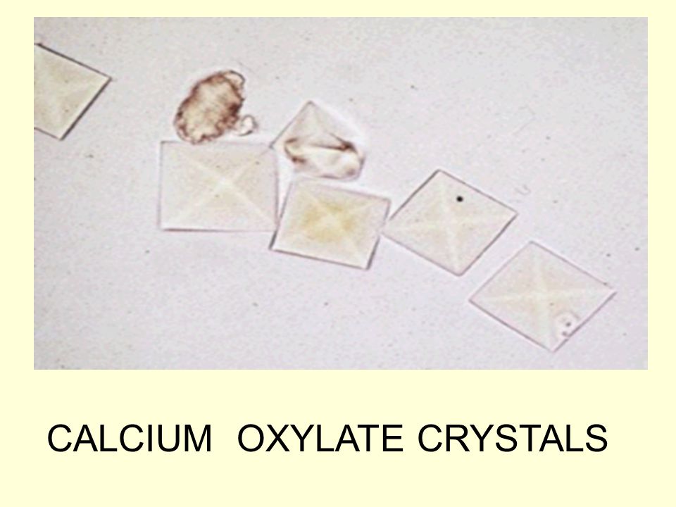 CALCIUM OXYLATE CRYSTALS