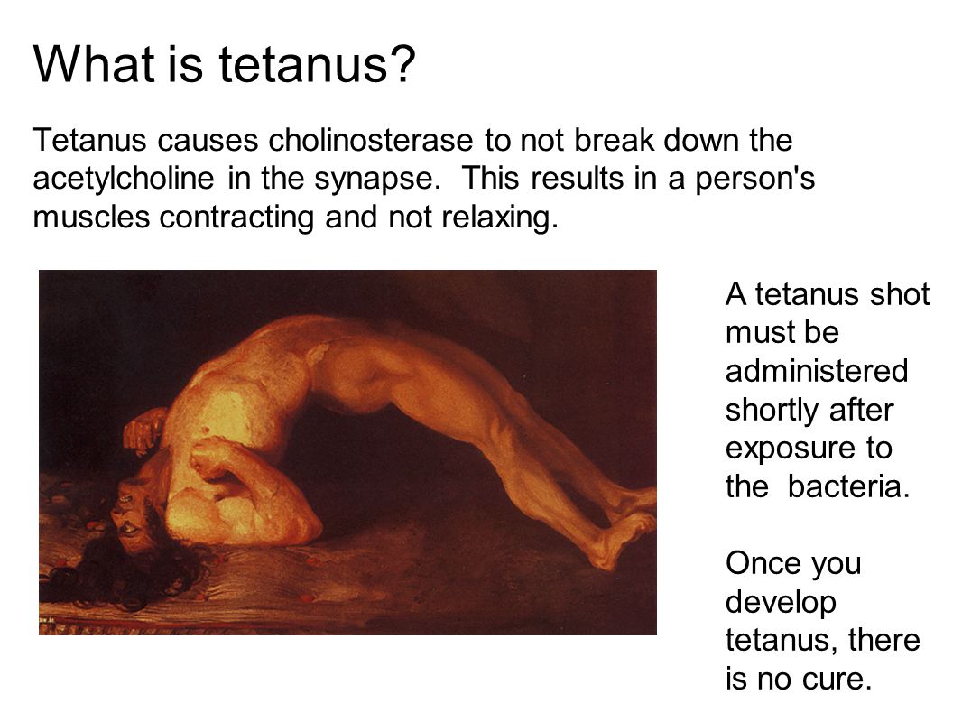 What is tetanus What is tetanus