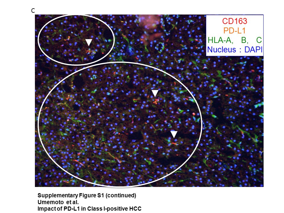 CD163 PD-L1 HLA-A, B, C Nucleus ： DAPI C Supplementary Figure S1 (continued) Umemoto et al.