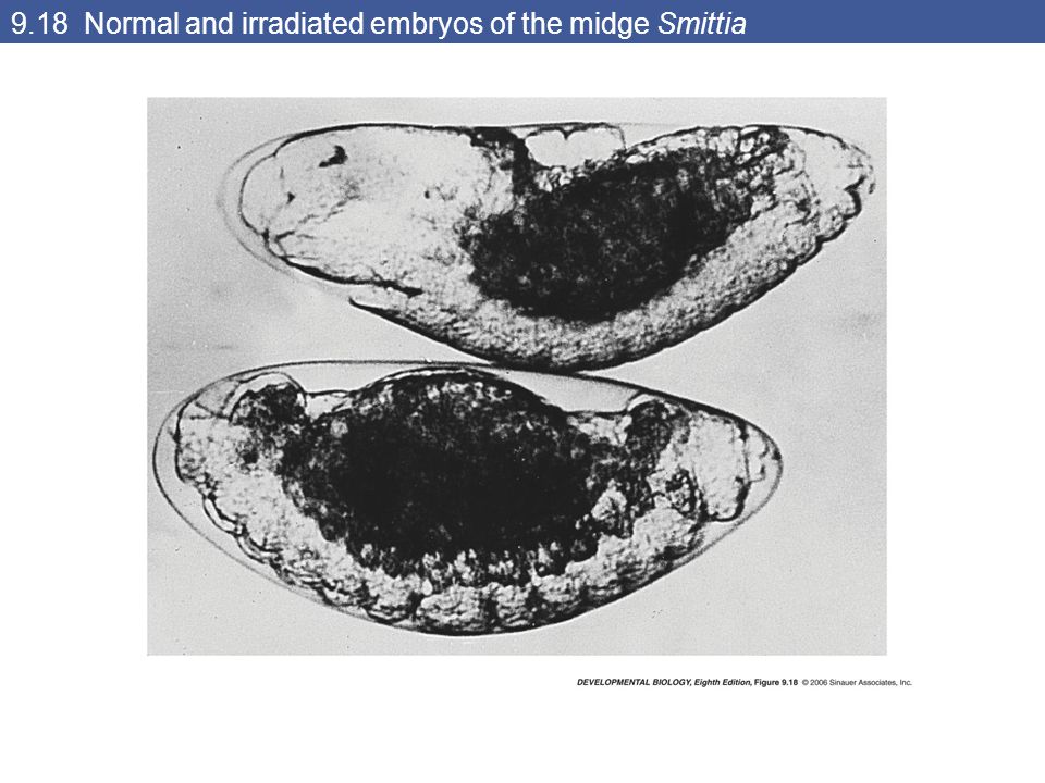 9.18 Normal and irradiated embryos of the midge Smittia