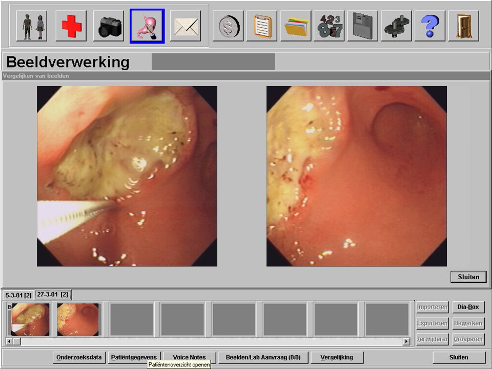 Ge Tc Get C Gastrointestinal Endoscopic Terminology Coding Get C Extension Of The Icd 10 M Groenen W Hirs H Becker E Kuipers G Van Berge Henegouwen Ppt Download
