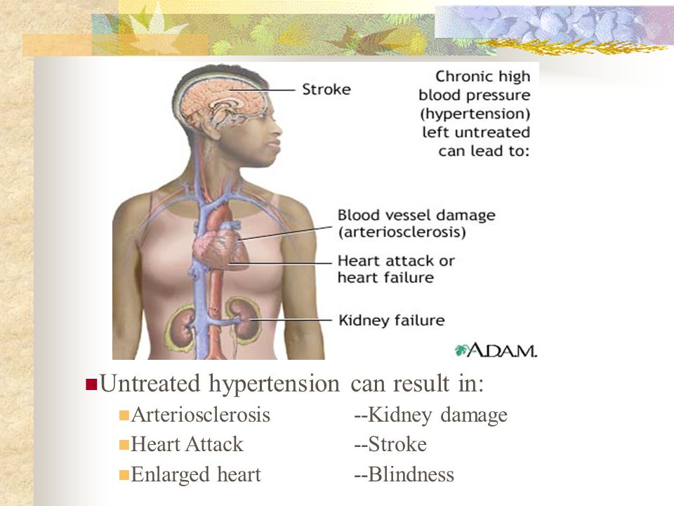 Untreated hypertension can result in: Arteriosclerosis--Kidney damage Heart Attack--Stroke Enlarged heart--Blindness