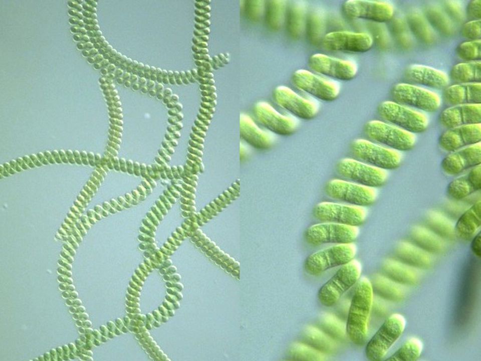 Цианобактерии спирулина. Спирулина платенсис. Spirulina водоросль. Многоклеточные цианобактерии.