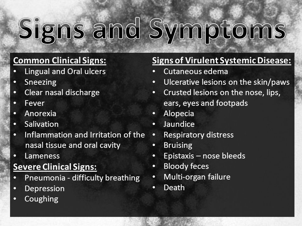Signs Of Jaundice Signs Of Jaundice