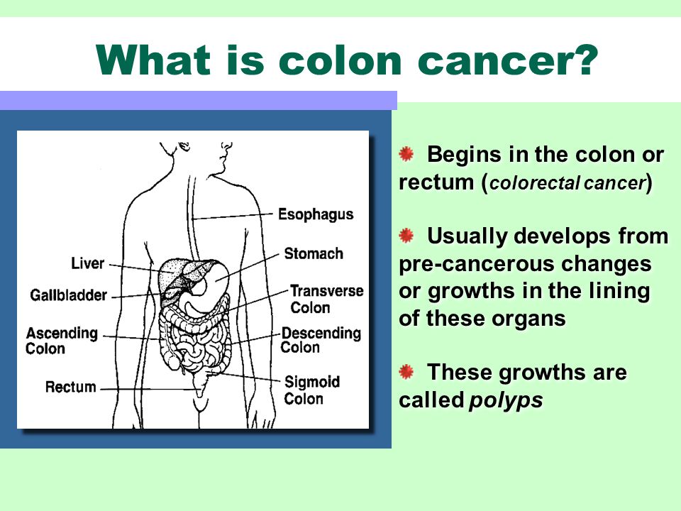 What is colon cancer.