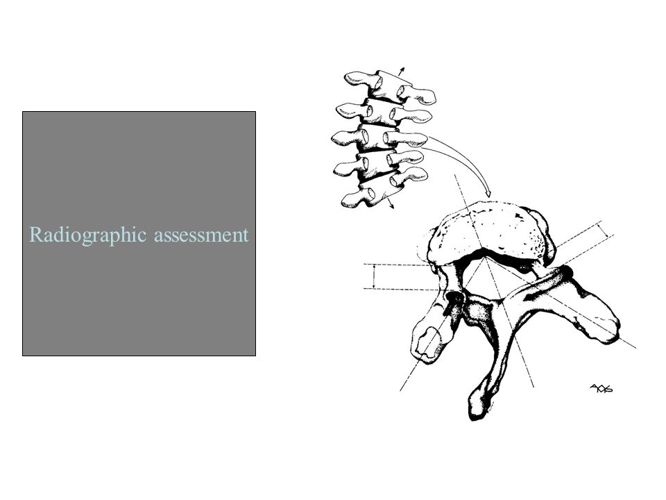 Radiographic assessment