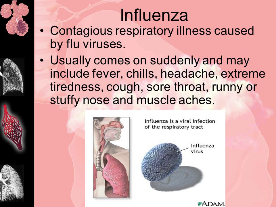 Influenza Contagious respiratory illness caused by flu viruses.