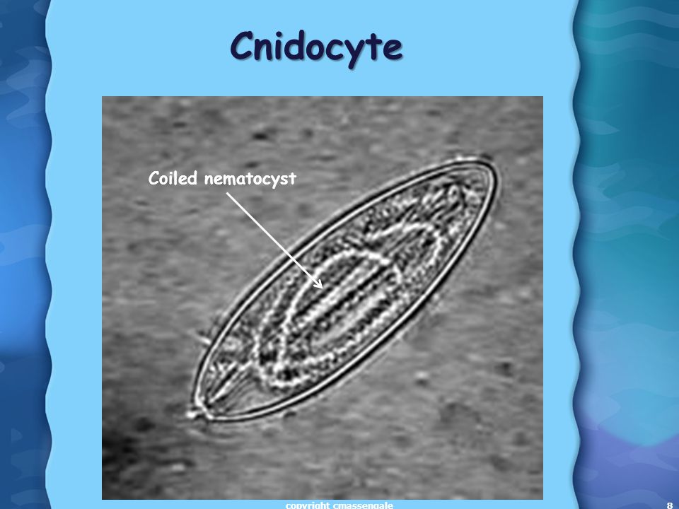 8 Cnidocyte Coiled nematocyst copyright cmassengale