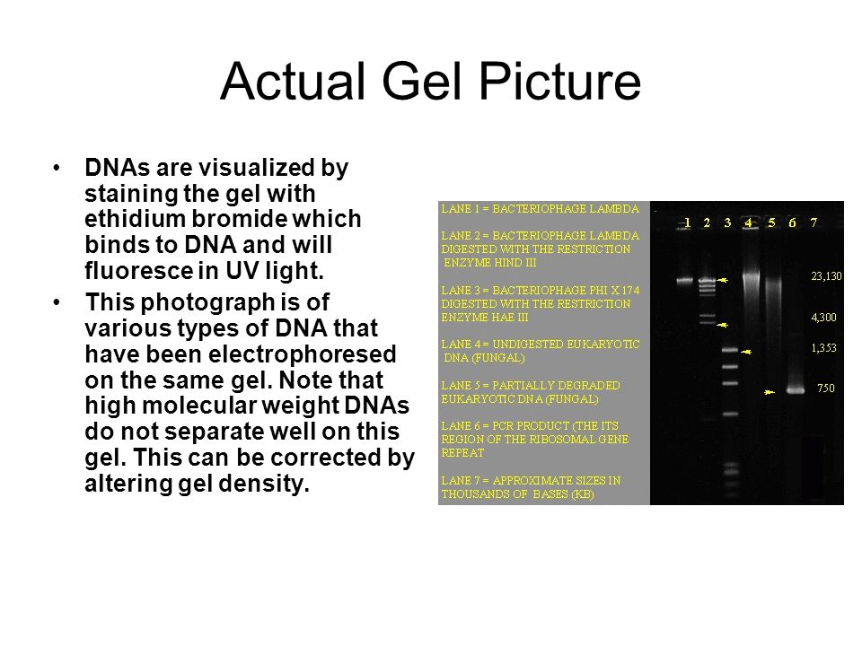 Actual Gel Picture DNAs are visualized by staining the gel with ethidium bromide which binds to DNA and will fluoresce in UV light.