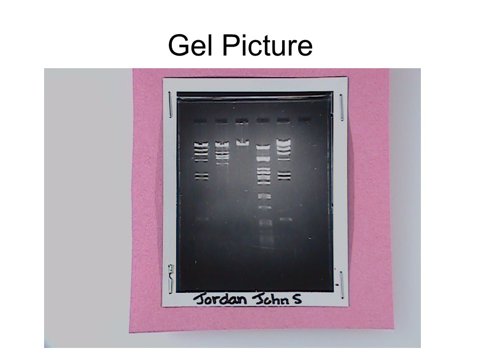 Gel Picture