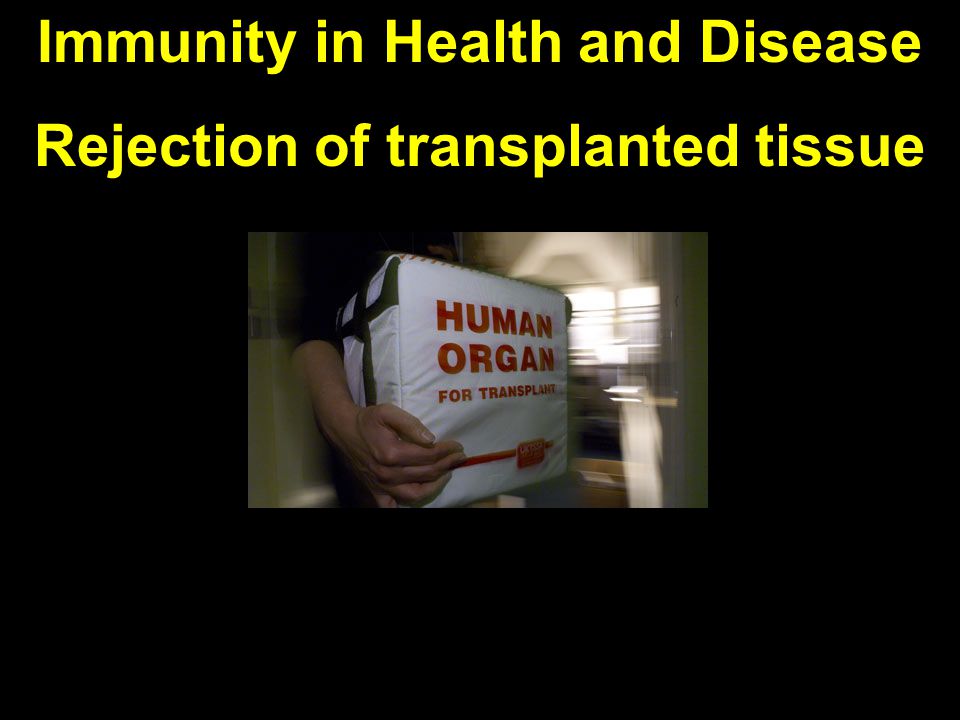 Immunity in Health and Disease Rejection of transplanted tissue
