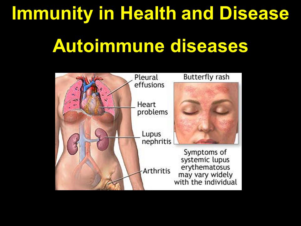 Immunity in Health and Disease Autoimmune diseases