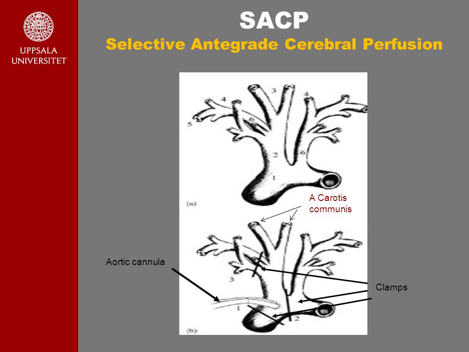 a comparison of cerebral and venous microdialysis during