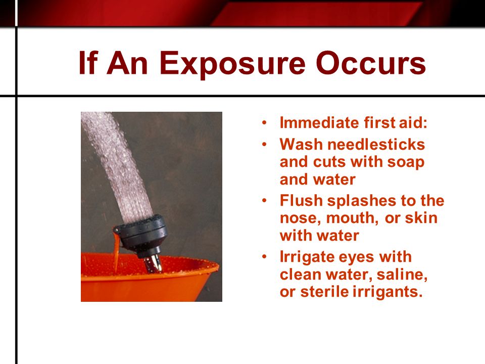 If An Exposure Occurs Immediate first aid: Wash needlesticks and cuts with soap and water Flush splashes to the nose, mouth, or skin with water Irrigate eyes with clean water, saline, or sterile irrigants.