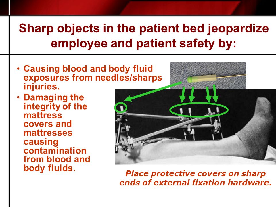 Sharp objects in the patient bed jeopardize employee and patient safety by: Causing blood and body fluid exposures from needles/sharps injuries.