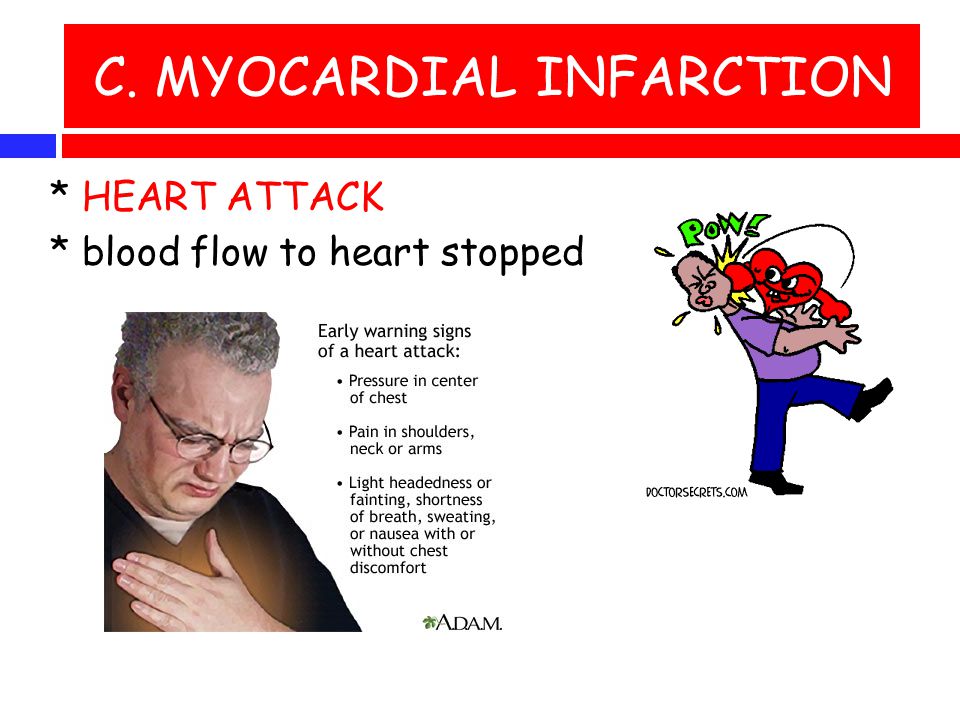 C. MYOCARDIAL INFARCTION * HEART ATTACK * blood flow to heart stopped