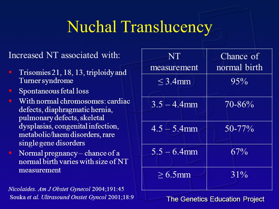 The Genetics Education Project Nuchal Translucency Increased NT associated ...
