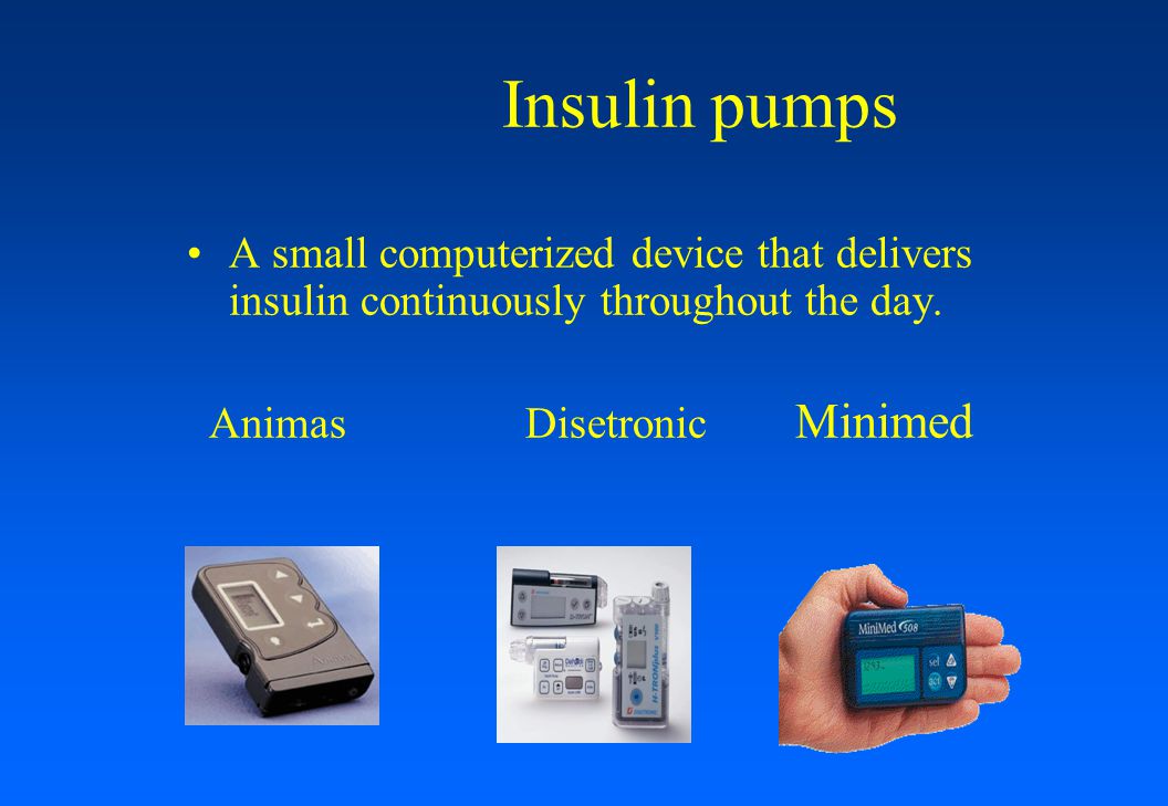 Insulin pumps A small computerized device that delivers insulin continuously throughout the day.