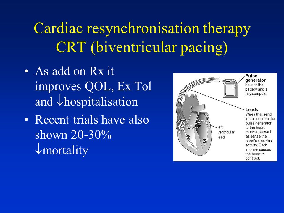 Cardiac resynchronisation therapy CRT (biventricular pacing) As add on Rx it improves QOL, Ex Tol and  hospitalisation Recent trials have also shown 20-30%  mortality
