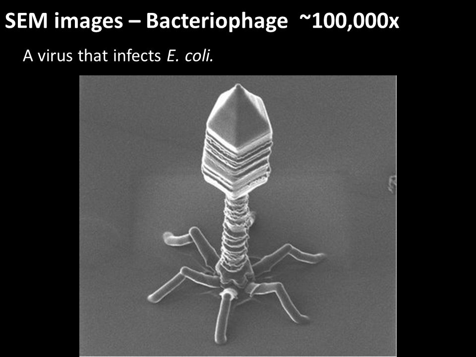 Как выглядит бактериофаг под микроскопом A New Scanning Electron Microscope Lakeview has just received a $77,000 grant to