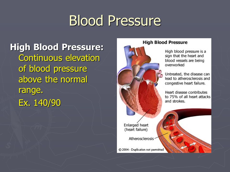 Blood Pressure High Blood Pressure: Continuous elevation of blood pressure above the normal range.