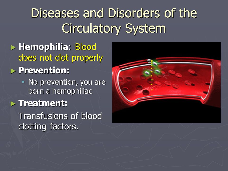 Diseases and Disorders of the Circulatory System ► Hemophilia: Blood does not clot properly ► Prevention:  No prevention, you are born a hemophiliac ► Treatment: Transfusions of blood clotting factors.