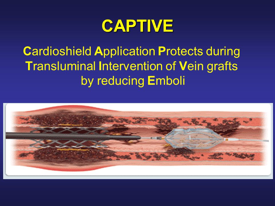 CAPTIVE Cardioshield Application Protects during Transluminal Intervention of Vein grafts by reducing Emboli