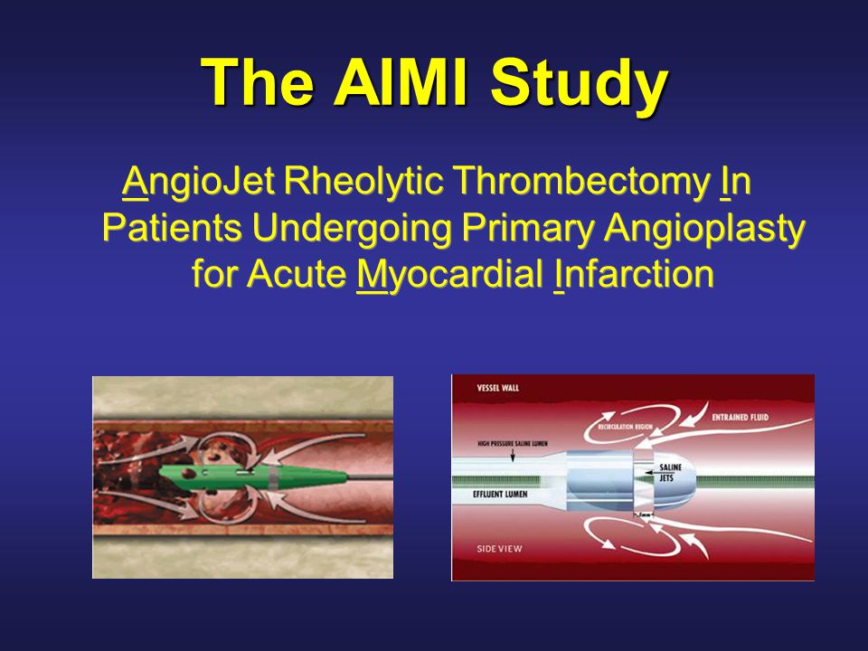 The AIMI Study AngioJet Rheolytic Thrombectomy In Patients Undergoing Primary Angioplasty for Acute Myocardial Infarction