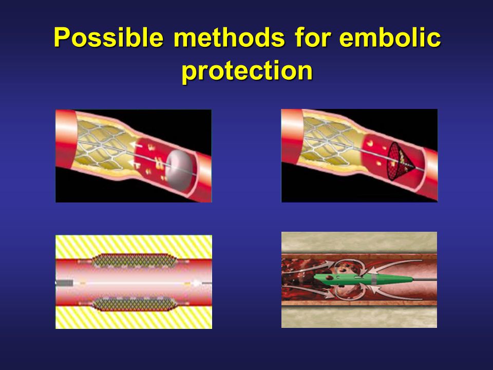 Possible methods for embolic protection