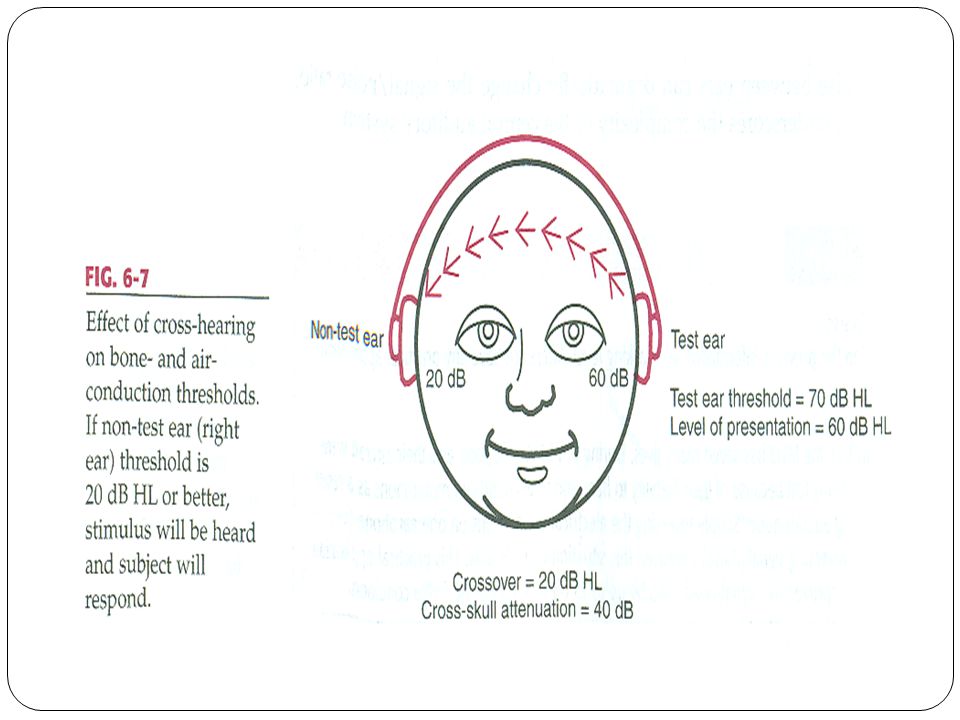 Let Faderlig Markeret Chapter 6: Masking. Masking Masking: a process in which the threshold of  one sound (signal) is raised by the presentation of another sound (masker).  Masking. - ppt download