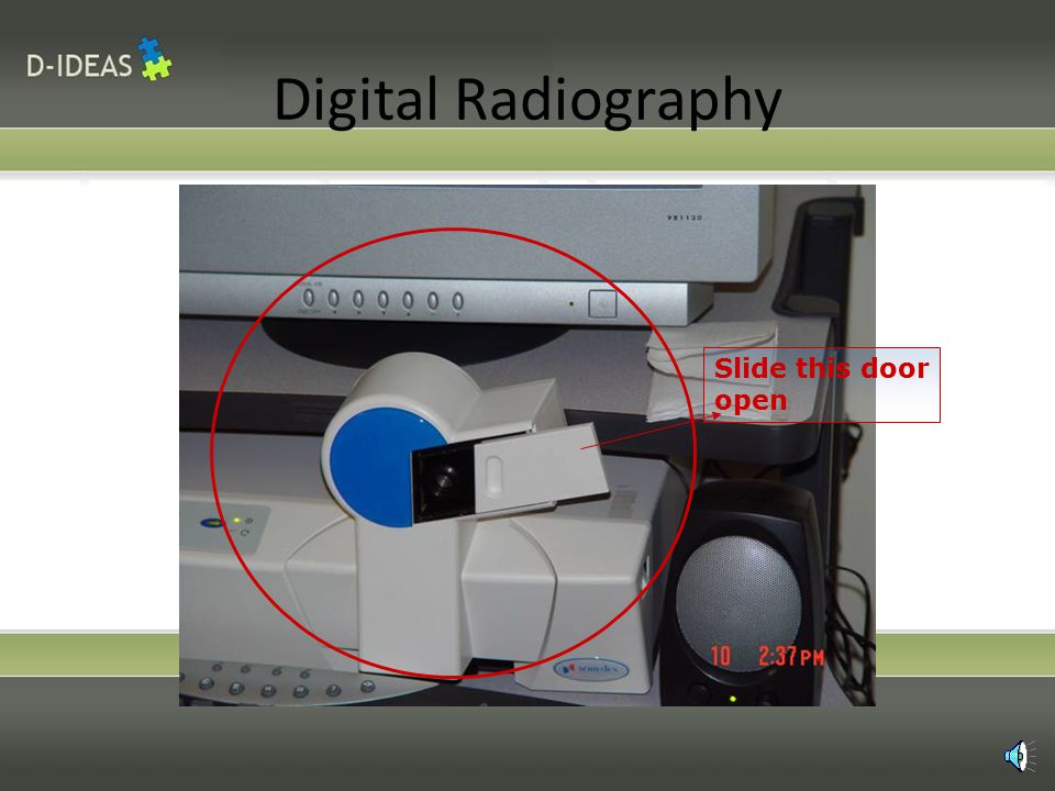 Digital Radiography 1.Insert the barriered sensor in the film holder on the Rinn holder