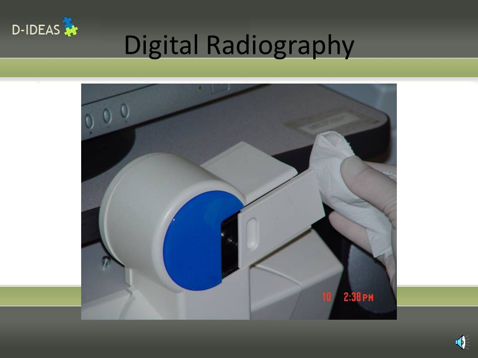 Digital Radiography Slide the sensor into the chamber for the computer to read the image