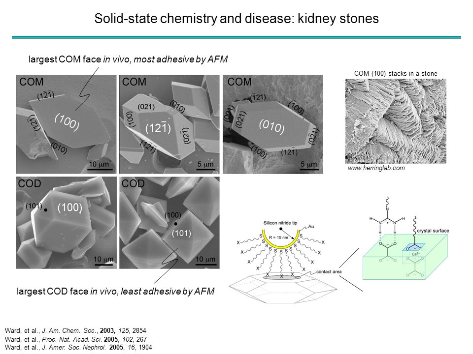 Solid-state chemistry and disease: kidney stones largest COM face in vivo, most adhesive by AFM largest COD face in vivo, least adhesive by AFM   COM (100) stacks in a stone Ward, et al., J.