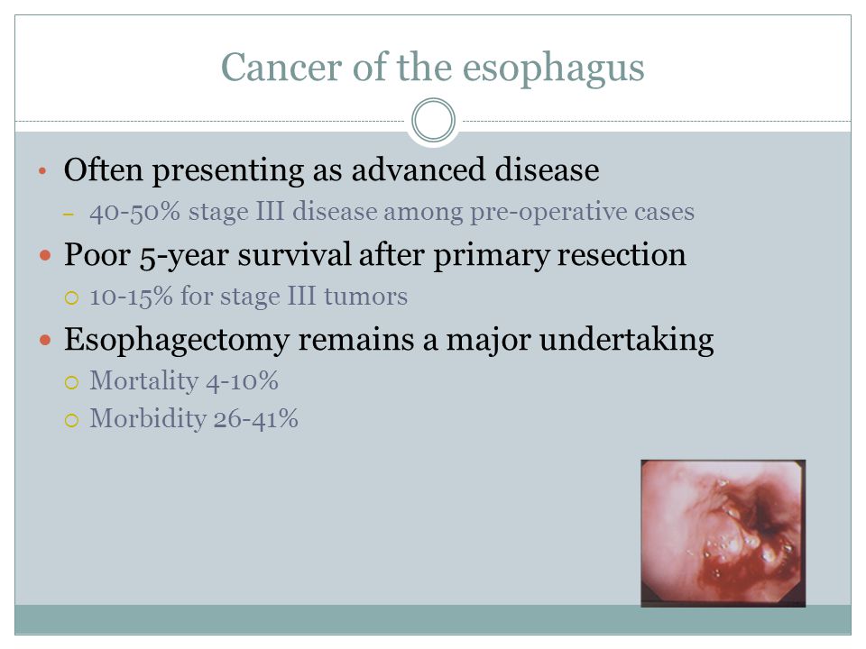 Cancer of the esophagus Often presenting as advanced disease – 40-50% stage III disease among pre-operative cases Poor 5-year survival after primary resection  10-15% for stage III tumors Esophagectomy remains a major undertaking  Mortality 4-10%  Morbidity 26-41%