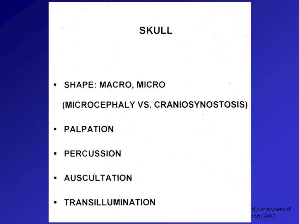 Neurobehavioral Assessment Of The Newborn 2003 Sourasky Tel Medical Center1 Neurobehavioral Assessment Of The Newborn Prof Shaul Harel Ppt Download