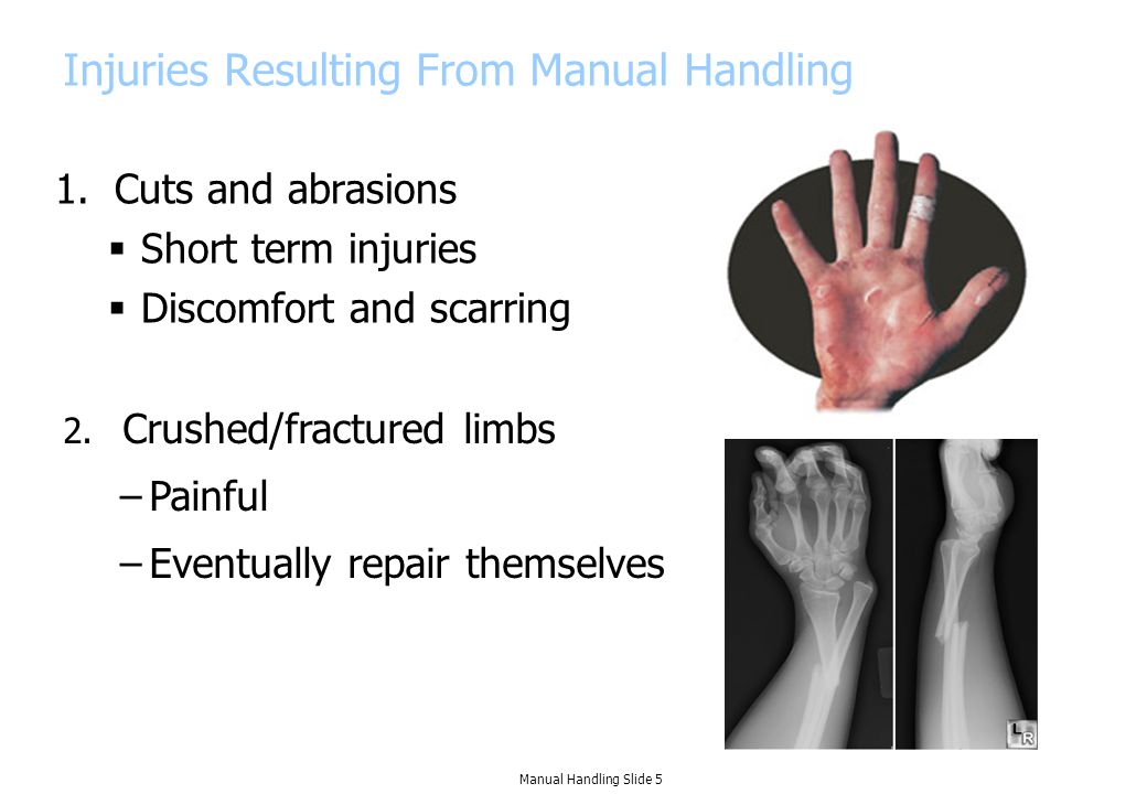 1.Cuts and abrasions  Short term injuries  Discomfort and scarring Injuries Resulting From Manual Handling 2.