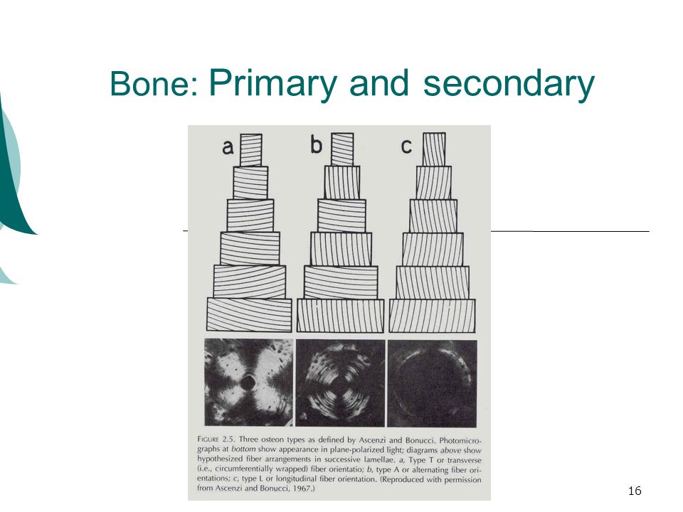 16 Bone: Primary and secondary