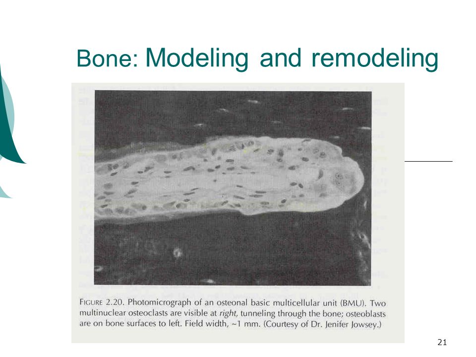 21 Bone: Modeling and remodeling