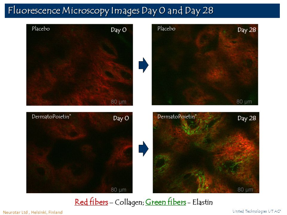 Fluorescence Microscopy Images Day 0 and Day 28 Neurotar Ltd, Helsinki, Finland United Technologies UT AG© Red fibers – Collagen; Green fibers - Elastin Day 0 Day 28
