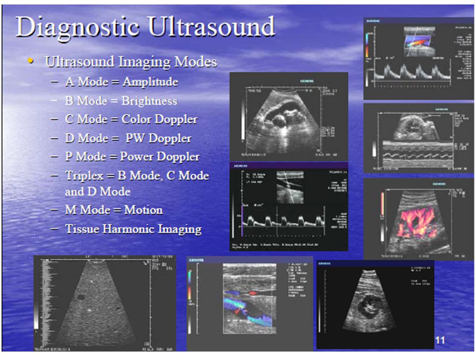 The A, B, M's – Ultrasound Modes Explained
