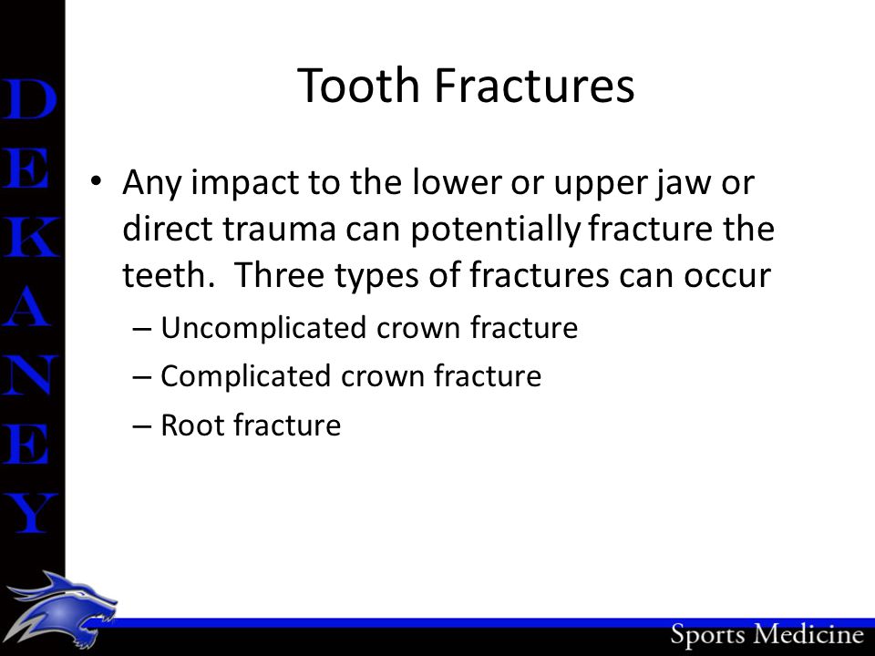 Tooth Fractures Any impact to the lower or upper jaw or direct trauma can potentially fracture the teeth.