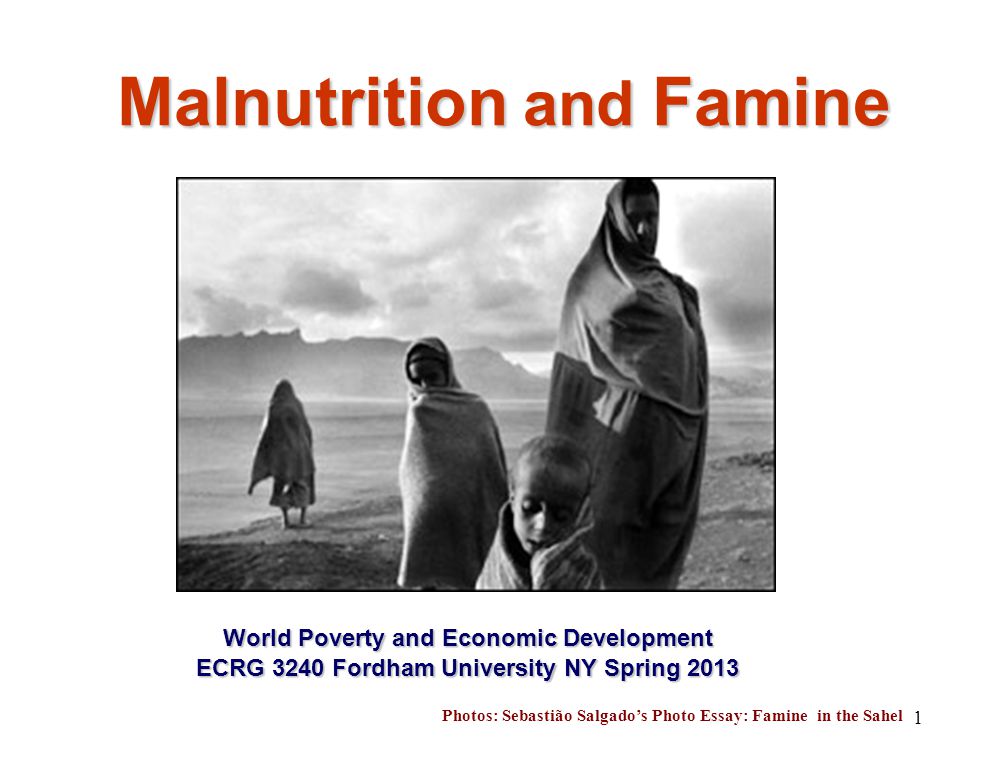 Malnutrition And Famine World Poverty And Economic Development Malnutrition And Famine World Poverty And Economic Development Ecrg Fordham University Ny Spring Photos Sebastio Salgados Photo Essay