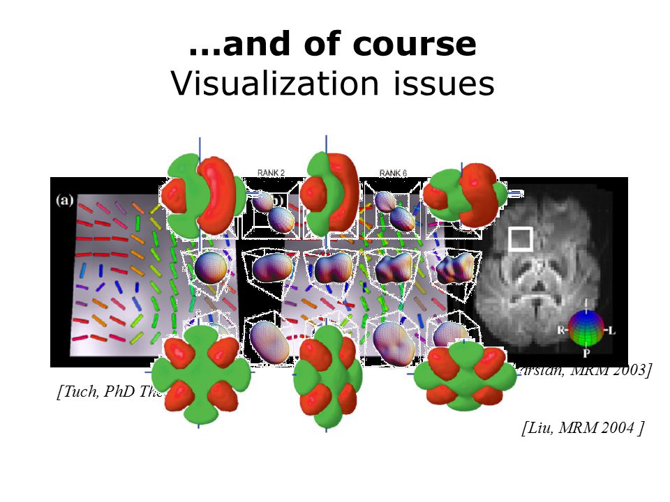 …and of course Visualization issues [Tuch, PhD Thesis 2002] [Ozarslan, MRM 2003] [Liu, MRM 2004 ]