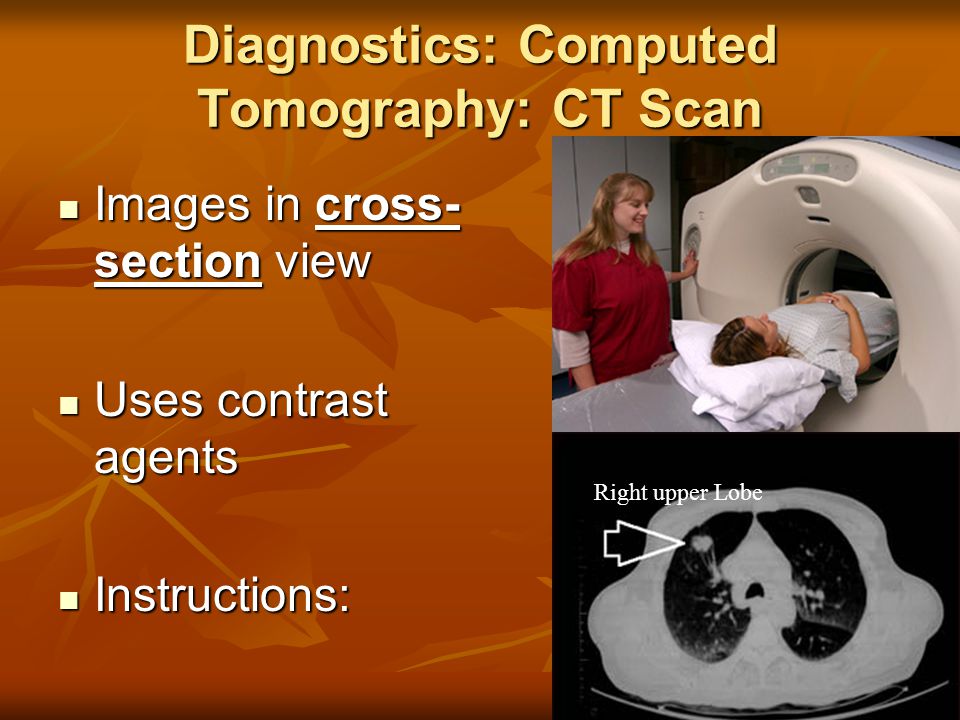 Diagnostics: Computed Tomography: CT Scan Images in cross- section view Images in cross- section view Uses contrast agents Uses contrast agents Instructions: Instructions: Right upper Lobe