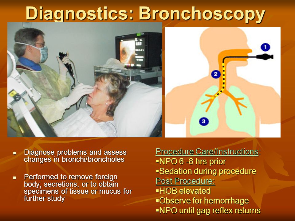 Diagnostics: Bronchoscopy Diagnose problems and assess changes in bronchi/bronchioles Diagnose problems and assess changes in bronchi/bronchioles Performed to remove foreign body, secretions, or to obtain specimens of tissue or mucus for further study Performed to remove foreign body, secretions, or to obtain specimens of tissue or mucus for further study Procedure Care/Instructions:  NPO 6 -8 hrs prior  Sedation during procedure Post Procedure:  HOB elevated  Observe for hemorrhage  NPO until gag reflex returns