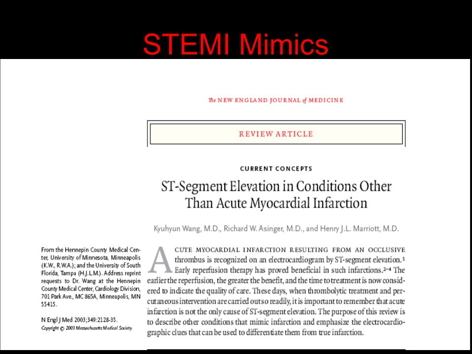 STEMI Mimics