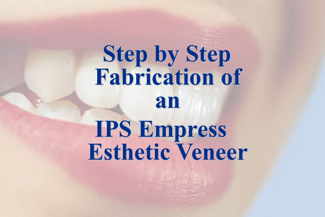 IPS Empress Esthetic Shade selection / Adhesive preparationAdhesive technique Step-by-step IPS Empress Esthetic Veneer Step-by-step IPS Empress Esthetic partial crown Clinical long-term studiesCommunicationThe success story 18 Step by Step Fabrication of an Step by Step Fabrication of an IPS Empress Esthetic Veneer