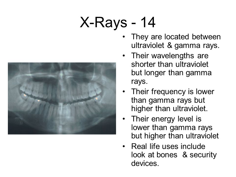 X-Rays - 14 They are located between ultraviolet & gamma rays.