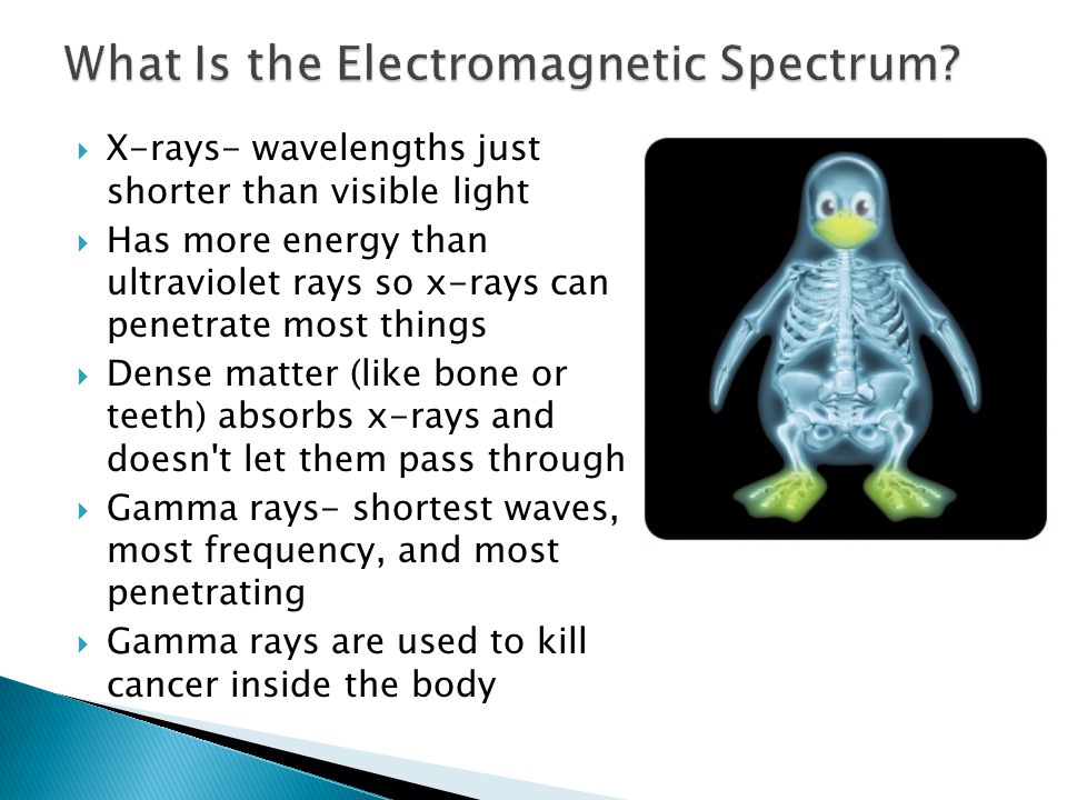  X-rays- wavelengths just shorter than visible light  Has more energy than ultraviolet rays so x-rays can penetrate most things  Dense matter (like bone or teeth) absorbs x-rays and doesn t let them pass through  Gamma rays- shortest waves, most frequency, and most penetrating  Gamma rays are used to kill cancer inside the body