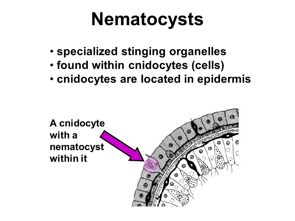 Nematocysts specialized stinging organelles found within cnidocytes (cells) cnidocytes are located in epidermis A cnidocyte with a nematocyst within it
